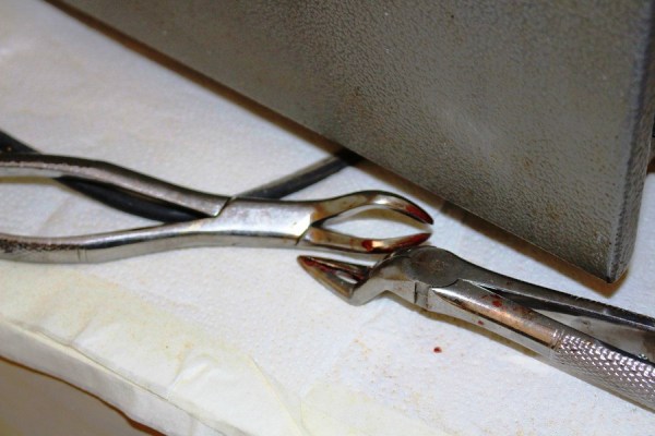 Vigilância Sanitária interdita clínicas odontológicas ilegais em Linhares