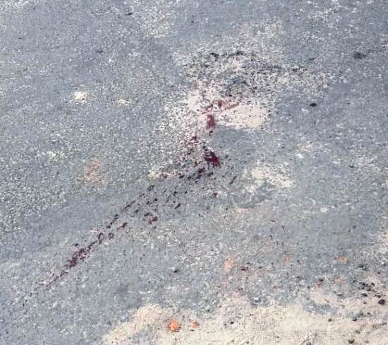 Homem é chamado pelo nome, baleado e tem moto roubada no Santa Cruz