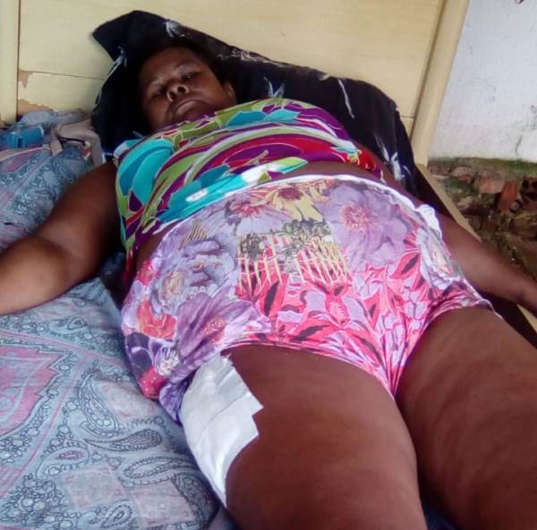 Ciclista atropelada pede ajuda. O que será de mim até poder trabalhar?