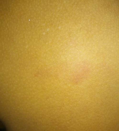 Mãe denuncia suposta agressão em escola de Linhares