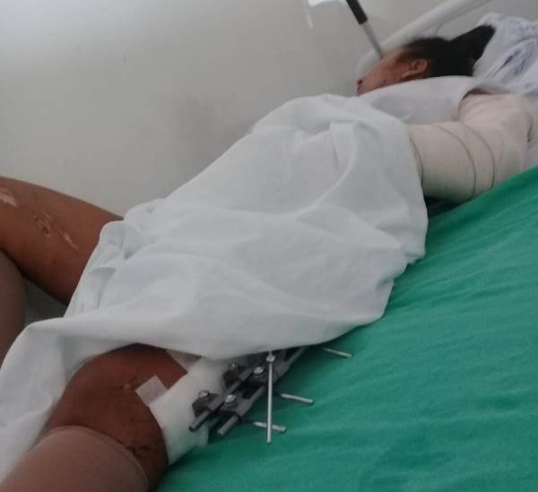 Sogra pede ajuda para nora acidentada. Causador não ajudou em nada, disse ela