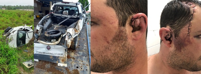 Preciso encontrar quem bateu no meu carro, diz vítima de acidente na Estrada do Pontal