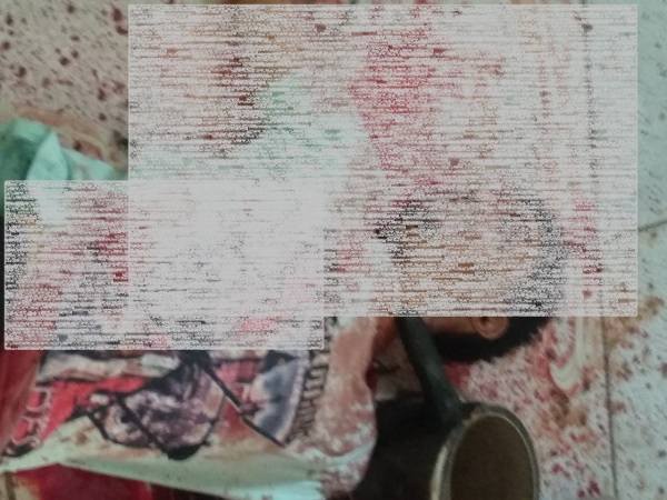 Sooretama: Jovem levou cinco tiros e teve mãos dilaceradas