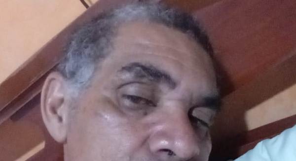 Mototaxista é agredido quando esperava cliente no Centro de Linhares