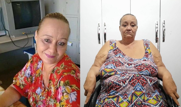 Professora aposentada pede ajuda para tratar da saúde