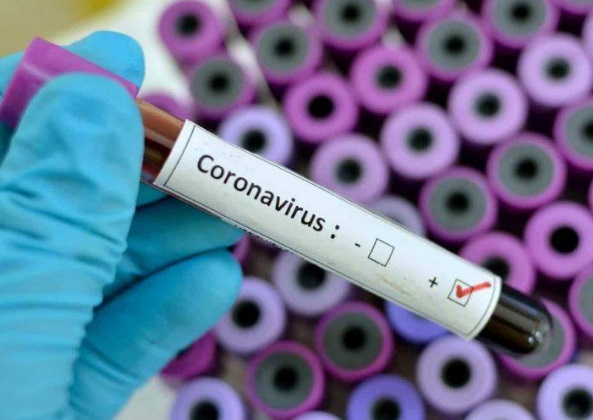 Boletim Extra: Mais um óbito por coronavírus em Linhares