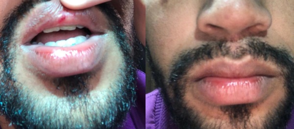 Batatinha é espancado ao sair de casa, no Interlagos