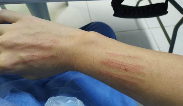Técnica de enfermagem é agredida por colega de trabalho dentro do HGL