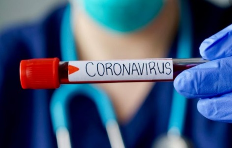 Linhares chega a quase 1600 casos do novo coronavírus