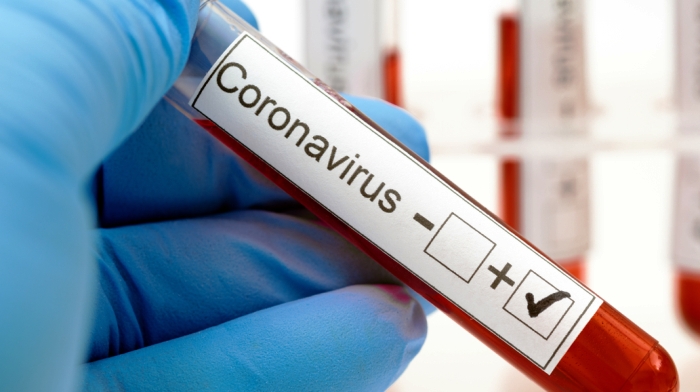 Portaria torna obrigatória notificação de resultados de testes da Covid-19