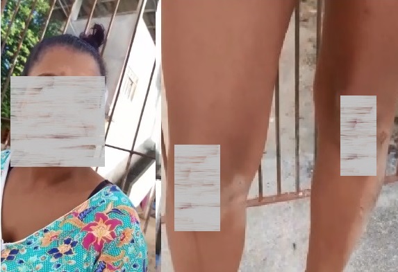 Mulher chama homem de chifrudo, espanca e tenta matar rival no Interlagos