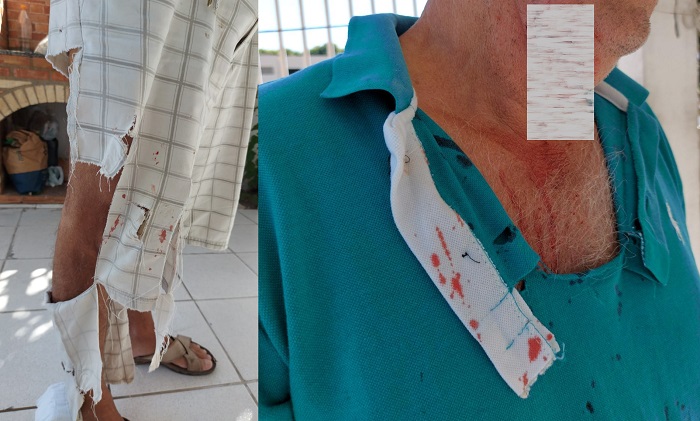 Idoso é atacado por cachorros e sofre sérios ferimentos no BNH