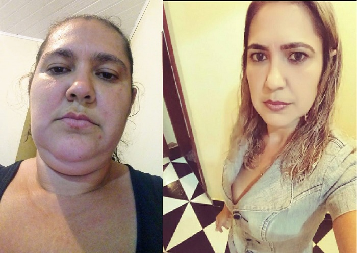 Perdeu quase 40 kg: Vítima de bullying na própria família, Flávia conta como foi a incrível “volta por cima”