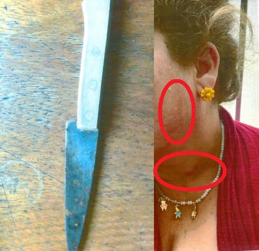 Homem agride e ameaça mulher com faca no interior de Linhares