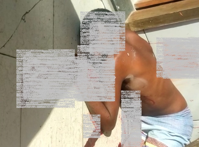 Cena de homem agonizando não foi no Aviso. 