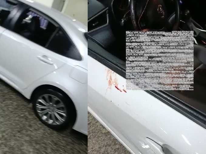 Homem baleado dirige próprio carro até hospital em Linhares. Uno e Corolla são citados na ocorrência