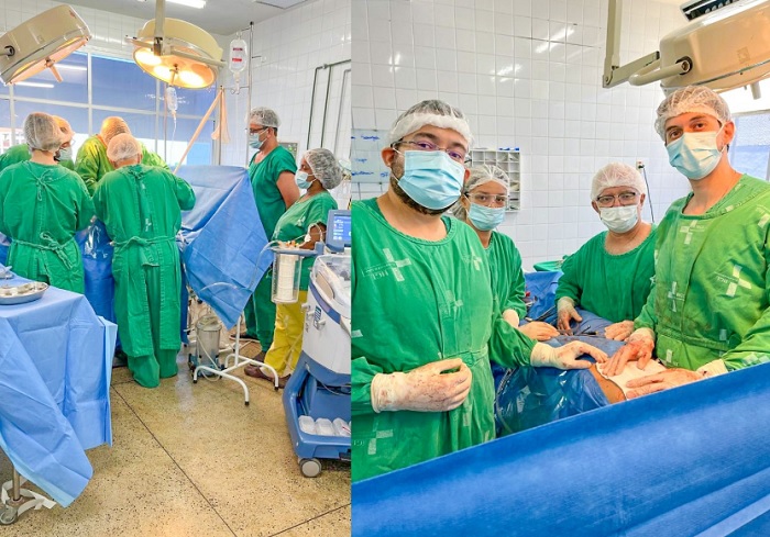 HGL realiza cirurgia inédita de hepactomia para retirada parcial do fígado