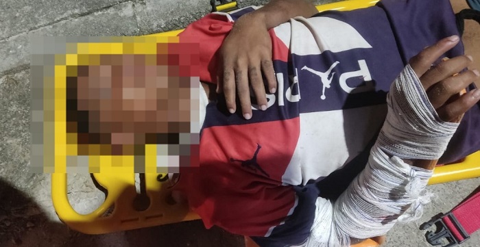Jocafe1: Suspeito de roubo de Biz socorrido após suposta ação de “justiceiros” em Linhares