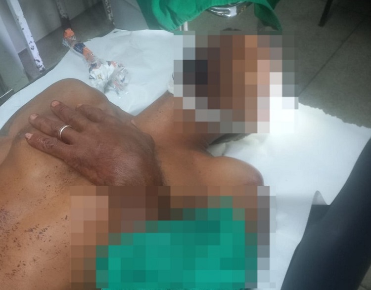 Foices e faca apreendidas: Tentativa de homicídio durante briga em Sooretama