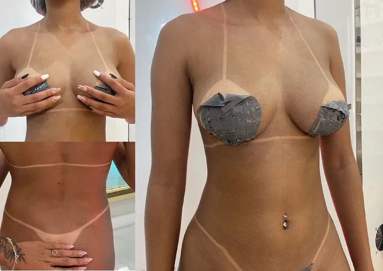 Marquinha de biquini em 20 minutos, e o bronzeamento ainda está em promoção em Linhares