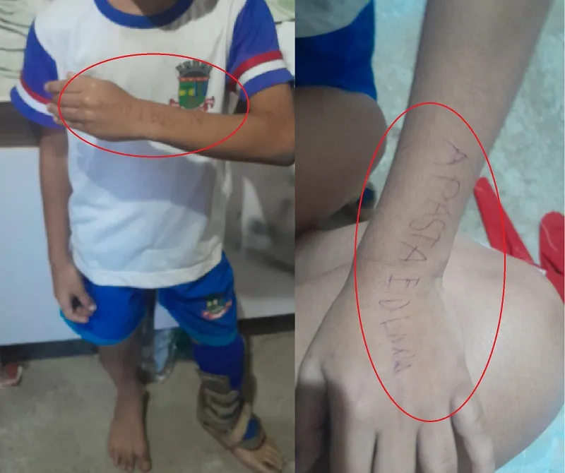 Linhares: Aluno é obrigado a escrever recado no braço, e não quer mais ir para a escola