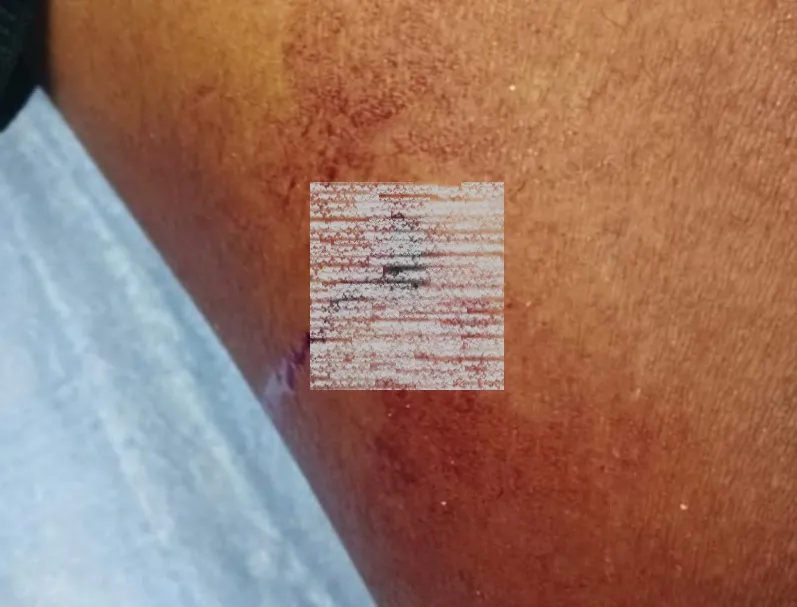 Menino baleado quando brincava na praça em Linhares, e em plena luz do dia