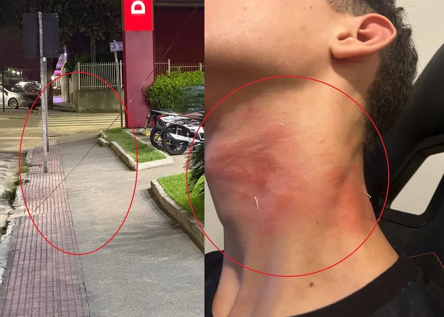 Fio atinge pescoço de ciclista e quase causa tragédia no Centro de Linhares
