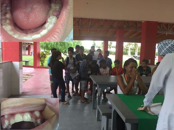 Perdas dentárias impressionam em megatriagem odontológica em Linhares