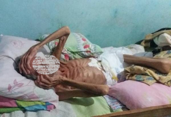 Internautas pedem ajuda para homem que há 4 anos vive acamado