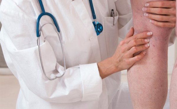 Trombose venosa: Fatores de risco, o que é, e prevenção e tratamento