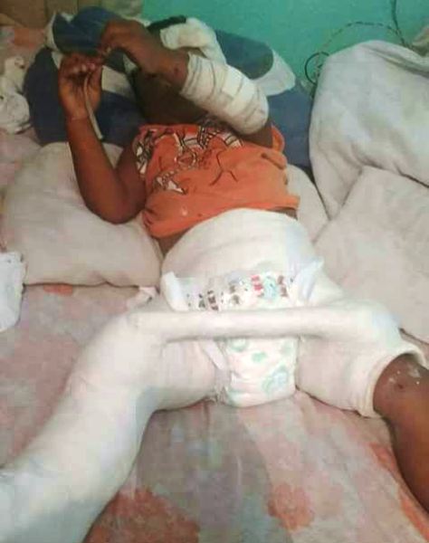 Militar propaga campanha para ajudar menino atropelado no Interlagos